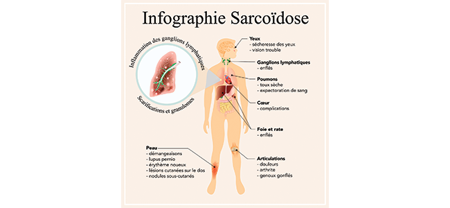 allergy specialist in lucknow,allergy specialist in up,asthma doctor in lucknow,asthma doctor in up,asthma specialist in lucknow