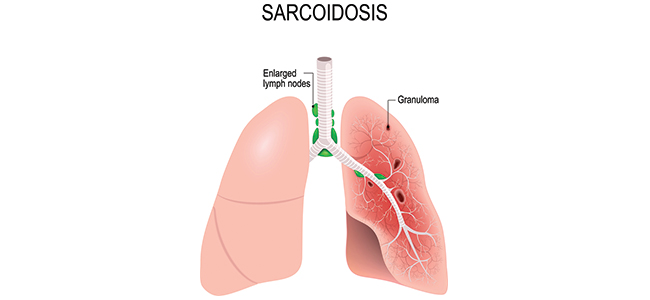 allergy specialist in lucknow,allergy specialist in up,asthma doctor in lucknow,asthma doctor in up,asthma specialist in lucknow