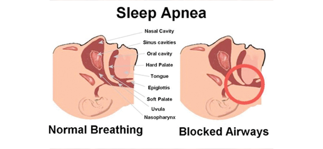 allergy specialist in lucknow,allergy specialist in up,asthma doctor in lucknow,asthma doctor in up,asthma specialist in lucknow